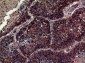 CD63 Polyclonal Antibody